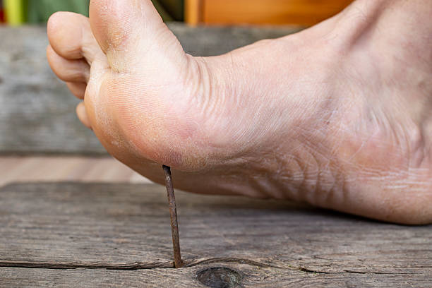 A nail in the foot dream biblically